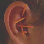 Øreakupunktur hos Indre Healing